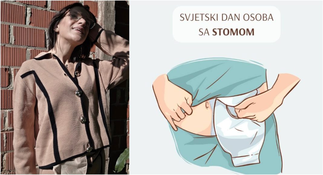 Monika Baranić iz Gardinovca: „Stoma mi je dala drugu priliku – da dišem, da se smijem, da postojim“ Monika Baranić iz Gardinovca: „Stoma mi je dala drugu priliku – da dišem, da se smijem, da postojim“